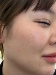 -长沙雅美医疗美容医院