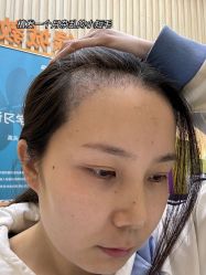 -雍禾植发全国连锁