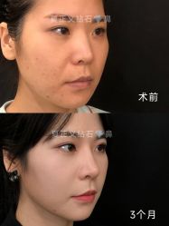 -北京米扬丽格医疗美容·联合丽格鼻整形中心