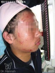 -韩医生专业祛痘连锁机构