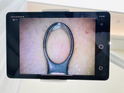 -凡碧诗毛孔清洁收细