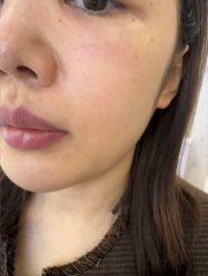 点击看大图 -长沙雅美医疗美容医院