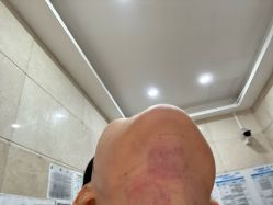 点击看大图 -深圳米兰柏羽医疗美容医院