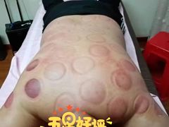 -沈师傅盲人按摩工作室(密三小区店)