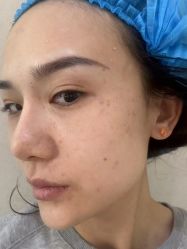 -坤如玛丽·医疗美容中心