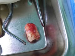 牙。。。。。-同济大学附属口腔医院