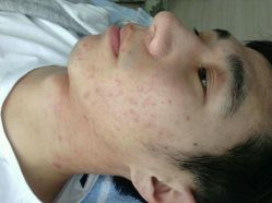 android_upload_pic-韩医生专业祛痘连锁机构