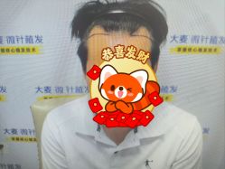 点击看大图 -大麦微针植发丨全国连锁