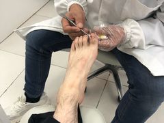 -新甲连锁灰指甲·甲沟炎·鸡眼(黑龙江路店)