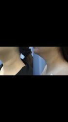 -广州健丽·去眼袋医疗美容机构