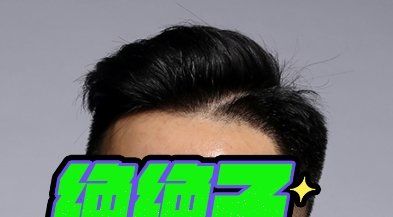 -大麦微针植发丨全国连锁