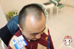 -大麦微针植发丨全国连锁