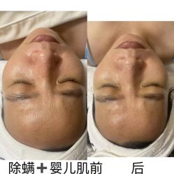 -LUNA皮相美·骨相美高级美感