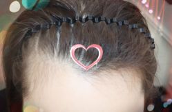 -大麦微针植发全国连锁