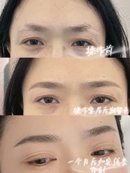 -杨益美学·野生眉半永久纹眉发际线