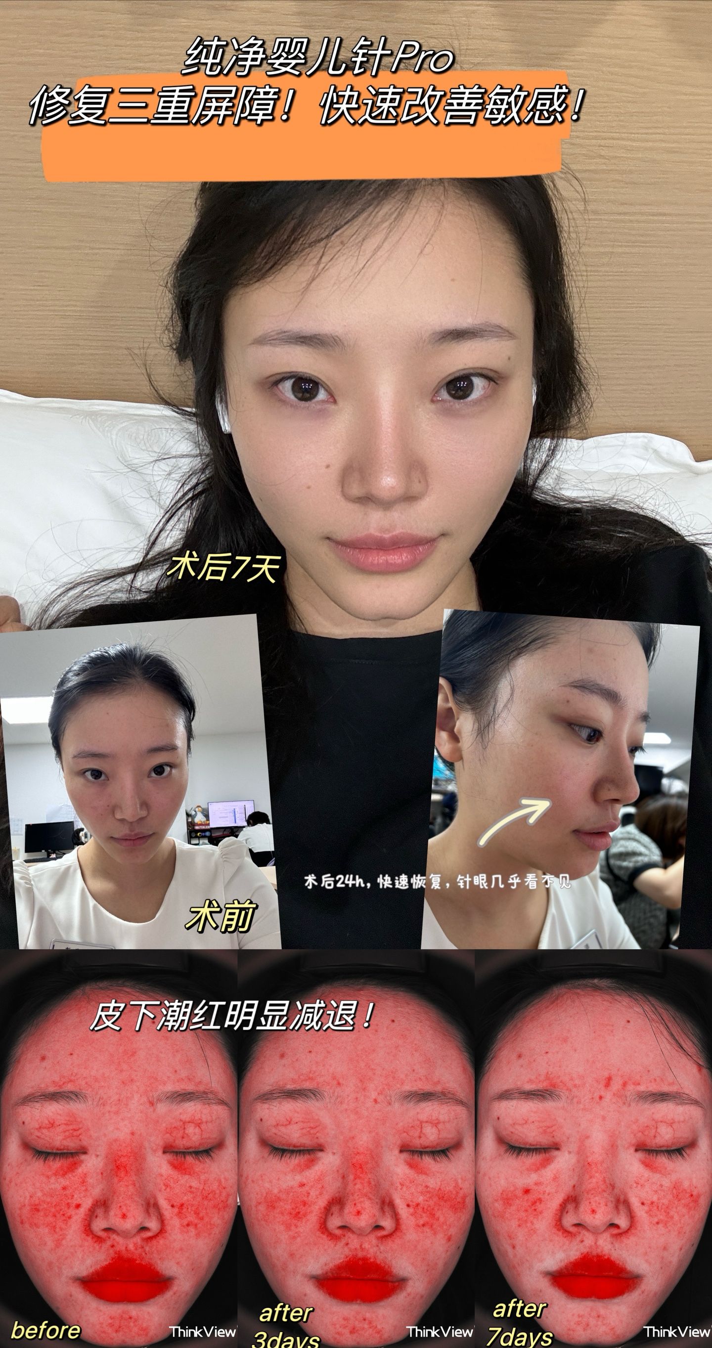 婴儿针前后效果图图片