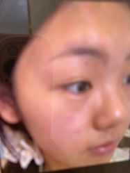 -长沙雅美医疗美容医院