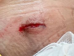 -首都医科大学附属北京天坛医院