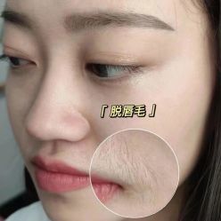 -薇兰专业脱毛连锁机构