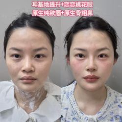 -深圳艺星医疗美容医院