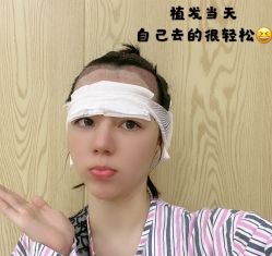 -碧莲盛·不剃发植发