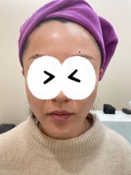 体验前-北京米扬丽格医疗美容·联合丽格鼻整形中心
