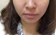 -SKINIST丽铂医疗美容