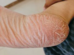 -朋朋修脚(音乐学院店)