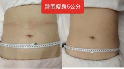 -Lily纤美·科技减脂中心