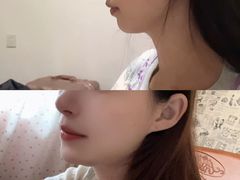 -极光口腔·矫正种植修复(锦江店)