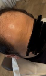 -乐绅男士高端假发定制