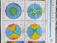 -美尔目眼科医院·近视手术·儿童近视(通州店)