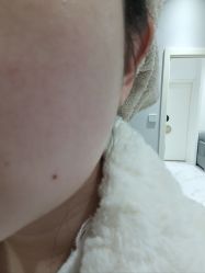 体验后-武汉颜范薇美医疗美容门诊部