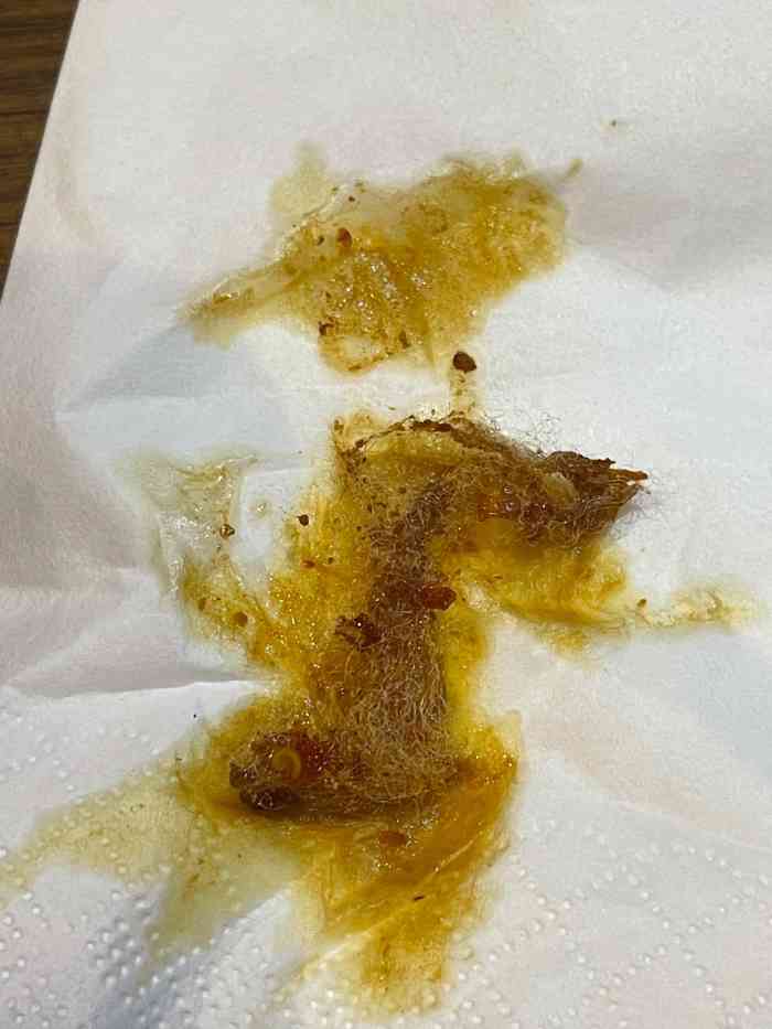 打分 恶心到我了 都快吃完了发现这一坨 不知道是