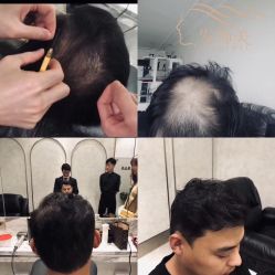 点击看大图 -发饰美男士增发补发假发定制店