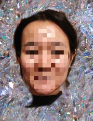 -八大处整形