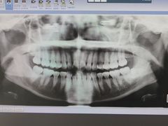 -浙江大学医学院附属第一医院(庆春院区)