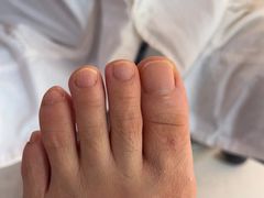 -新甲连锁灰指甲·甲沟炎·鸡眼(黑龙江路店)