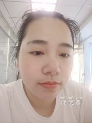 体验后-暨芒皮肤管理中心