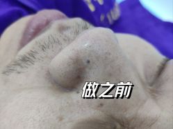 -蕾特恩专业祛痘·皮肤管理