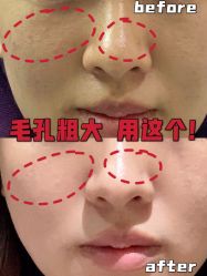 -广州美莱医疗美容医院