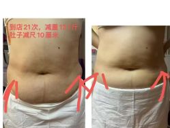 -丽减美瘦吧·减肥瘦身