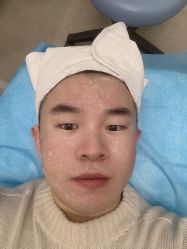 体验前-亿美医疗美容·半岛大超炮官方授权店
