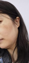 点击看大图 -广州美莱医疗美容医院