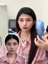 -Yestar重庆艺星医疗美容医院