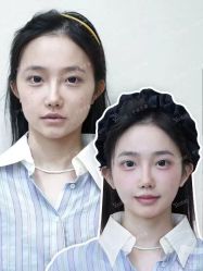 -Yestar宁波艺星整形医院