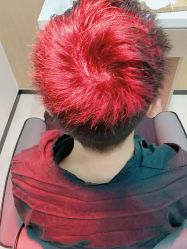 -雍禾植发全国连锁