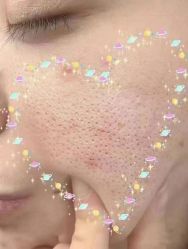 -痘庄科学祛痘国际连锁