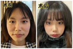 -素美医疗美容·西南眼鼻整形·修复基地