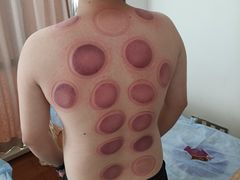 -张钰强中医正骨推拿连锁(华发商都店)